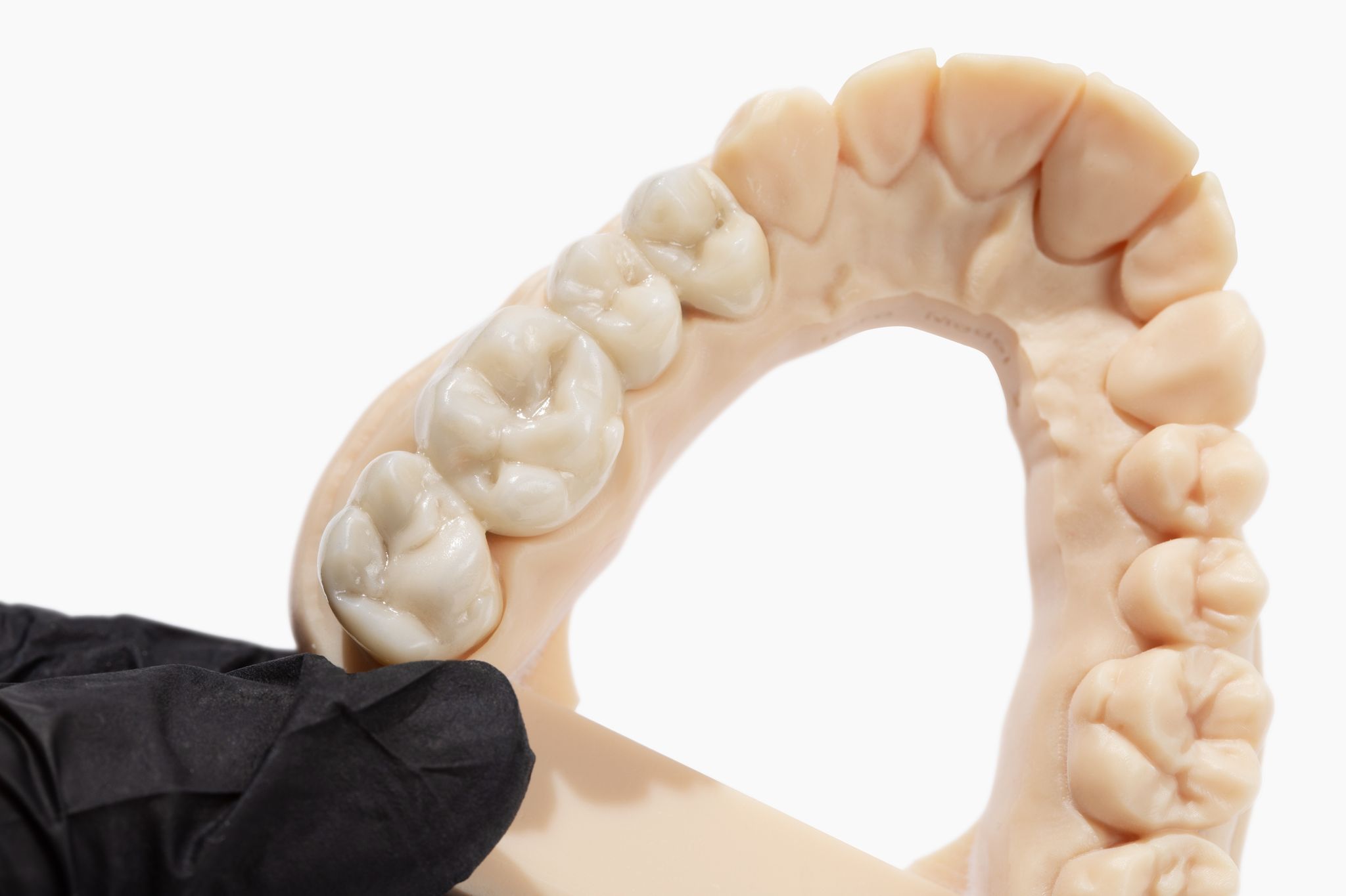 Dandy crown monolithic